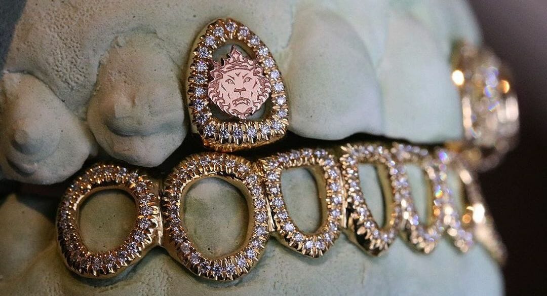 What You Should Know About Diamonds Dental Implants