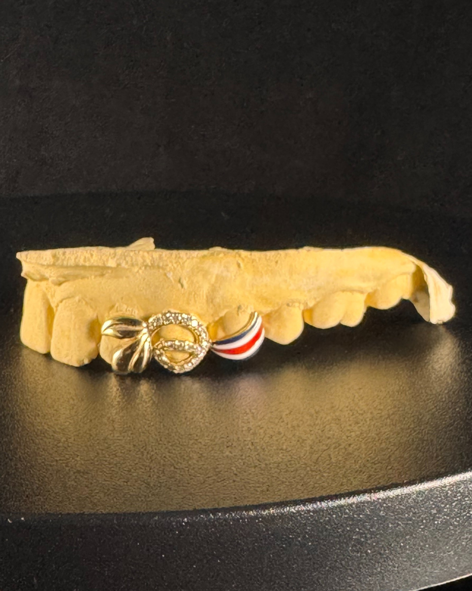 A diamond grillz designed by Jessenia Landrum